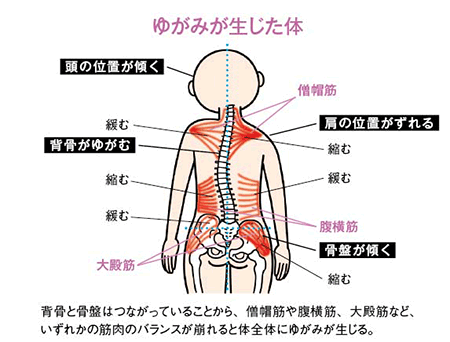 体 の 歪み 整体 京都