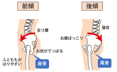 尾てい骨 出 てる