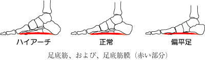 偏平足のことなら、京都市西京区の整体院【京都中丸整体カイロプラクティックへ】