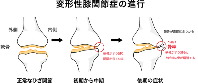 膝の痛みでお悩みなら京都市西京区の整体院【京都中丸整体カイロプラクティックへ】