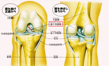 膝のスポーツ障害のことなら京都市西京区の整体院【京都中丸整体カイロプラクティックへ】