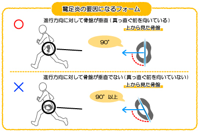 膝の内側の痛みのことなら【京都中丸整体カイロプラクティックへ】