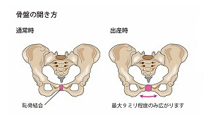 産後の骨盤の開き　画像